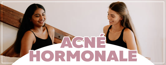 Comment calmer l'acné hormonale ?